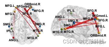 FNIRS功能近紅外數(shù)據(jù)處理服務(wù)